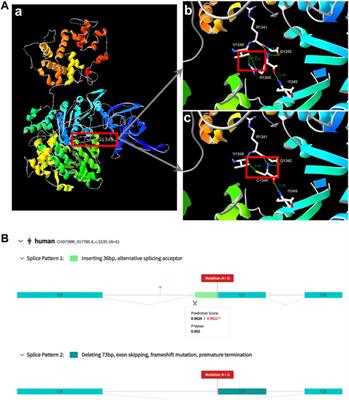 Exome sequencing improves genetic diagnosis of congenital orofacial clefts